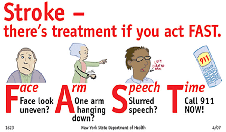 How to Handle and Treat a Stroke FAST - A Lifesaving Guide for American Stroke Month