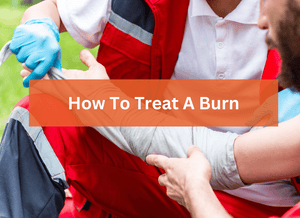How To Treat A Burn